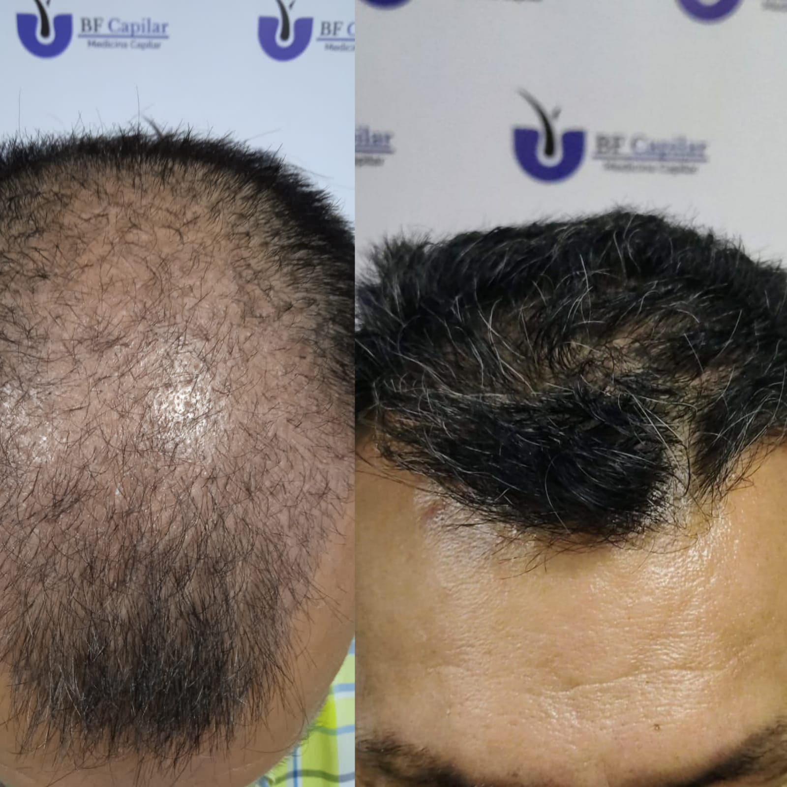 testimonio-de-tratamiendo-para-la-caida-del-cabello